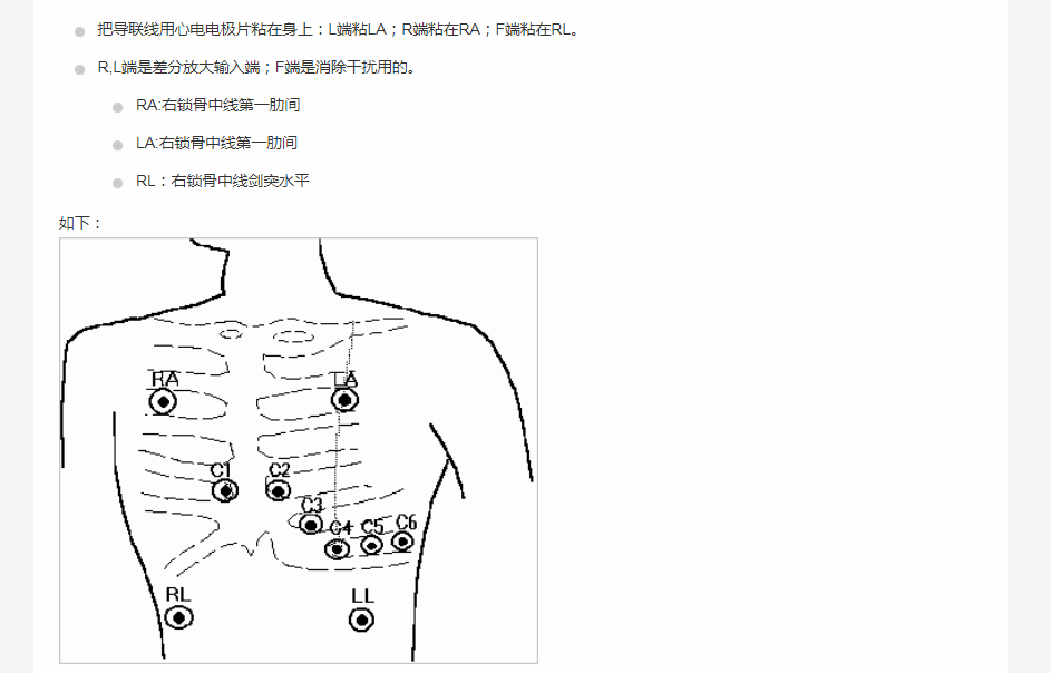 ECGʮ缫12.png